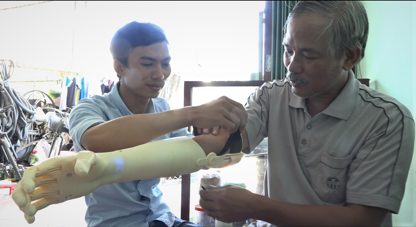 “Cánh tay robot cho người khuyết tật” Sáng chế nhân văn vì cộng đồng.